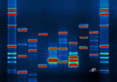 DNA-Analyse